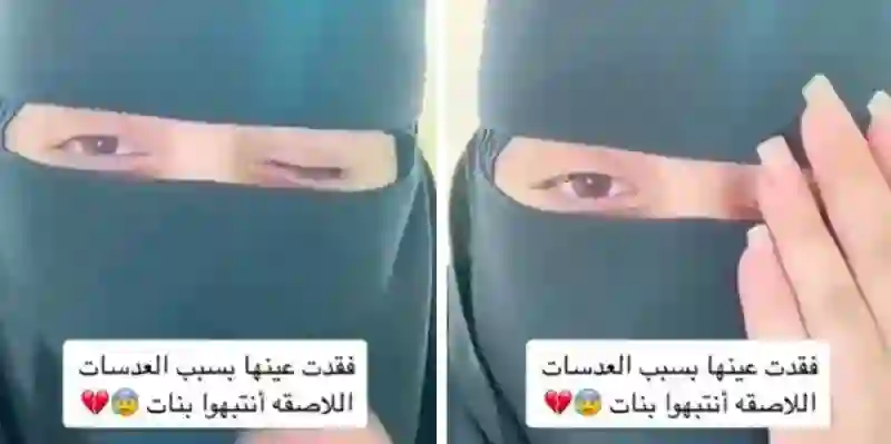 هذا النوع من العدسات اللاصقة المنتشر في السعودية يسبب تلف العين والعمى